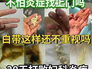 校花脱了内裤让我看尿口，私密护理液，让你远离异味瘙痒