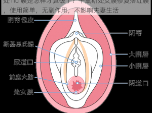 处 nu 膜是怎样才算破了？千黛斯处女膜修复落红膜，使用简单，无副作用，不影响夫妻生活