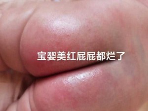 红屁股的教育 SP 调教小说——独特的性教育产品，帮助你探索未知的性世界