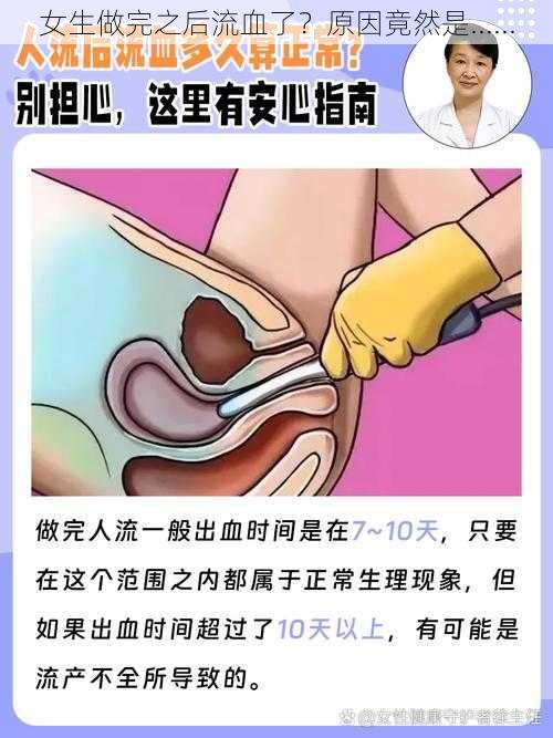 女生做完之后流血了？原因竟然是......