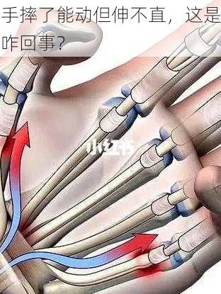 手摔了能动但伸不直，这是咋回事？