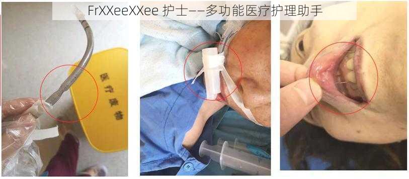 FrXXeeXXee 护士——多功能医疗护理助手