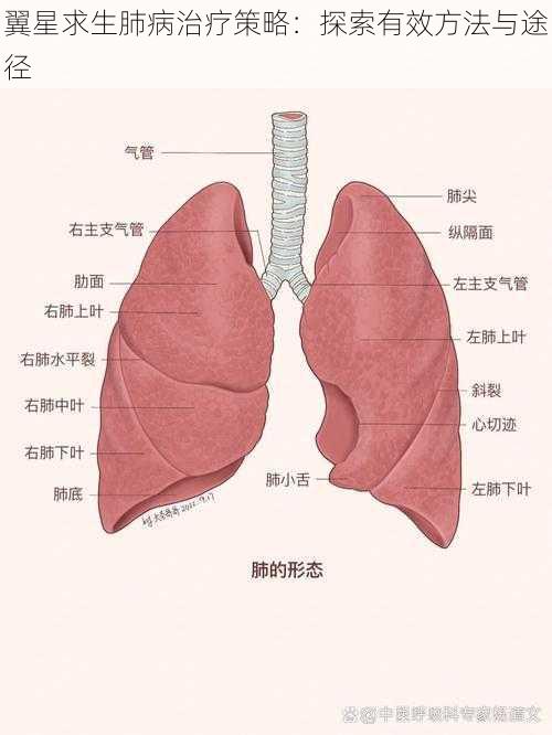 翼星求生肺病治疗策略：探索有效方法与途径