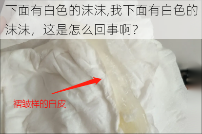 下面有白色的沫沫,我下面有白色的沫沫，这是怎么回事啊？